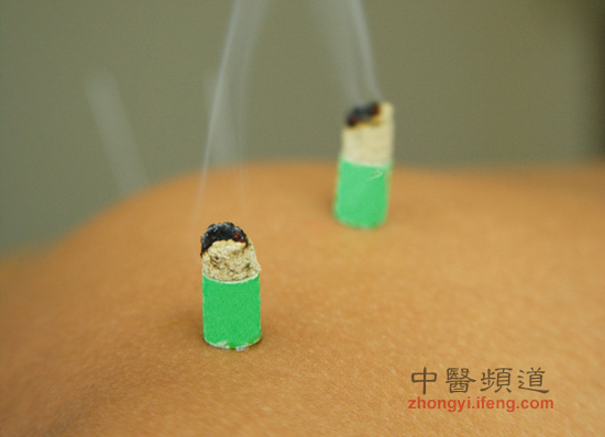 點(diǎn)擊將在新窗口查看全圖 小孩也可以艾灸保健 但要注意5點(diǎn)