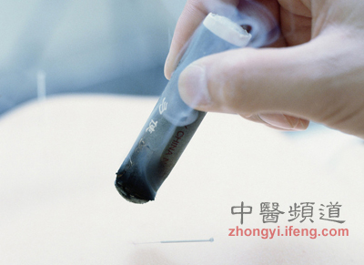 點(diǎn)擊將在新窗口查看全圖 小孩也可以艾灸保健 但要注意5點(diǎn)