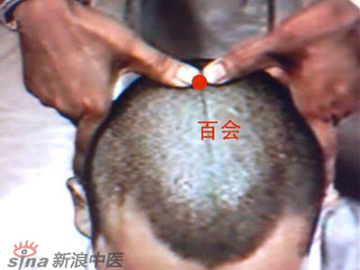艾灸常用的保健穴有哪些？--百會(huì)
