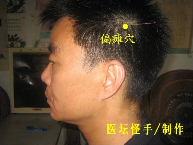 點(diǎn)擊將在新窗口查看全圖 王文遠(yuǎn)平衡針灸穴位圖 - 3396815 - 3396815博愛