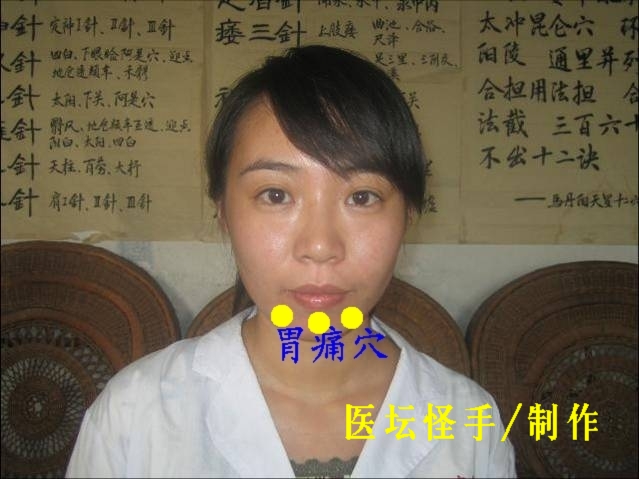 點(diǎn)擊將在新窗口查看全圖 王文遠(yuǎn)平衡針灸穴位圖 - 3396815 - 3396815博愛