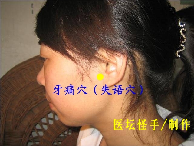 點(diǎn)擊將在新窗口查看全圖 王文遠(yuǎn)平衡針灸穴位圖 - 3396815 - 3396815博愛