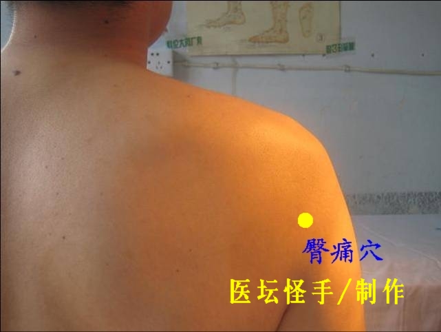 點(diǎn)擊將在新窗口查看全圖 王文遠(yuǎn)平衡針灸穴位圖 - 3396815 - 3396815博愛