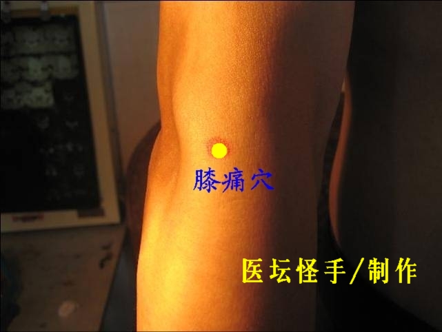 點(diǎn)擊將在新窗口查看全圖 王文遠(yuǎn)平衡針灸穴位圖 - 3396815 - 3396815博愛