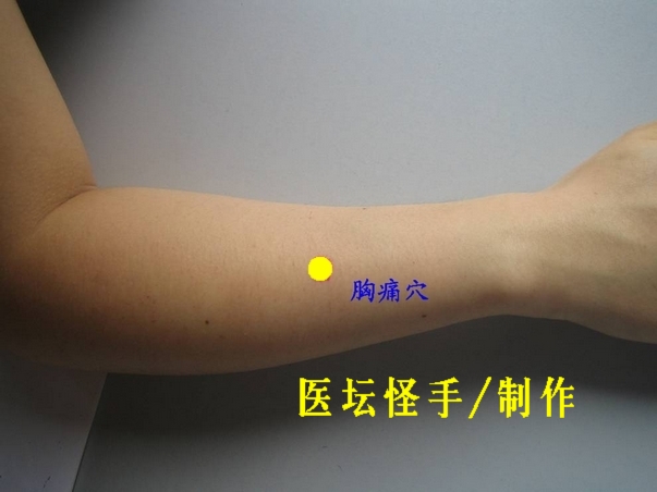 點(diǎn)擊將在新窗口查看全圖 王文遠(yuǎn)平衡針灸穴位圖 - 3396815 - 3396815博愛