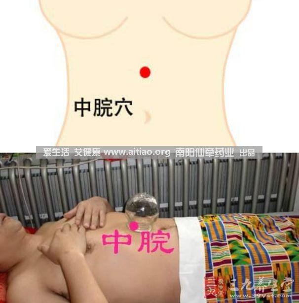 中脘穴位于腹部正中線(xiàn)，臍上4寸的位置上。每天艾灸10-15分鐘，能有效緩解胃部不適的癥狀，同時(shí)有助于祛濕。