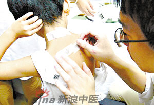 灸法的種類  你知道多少？